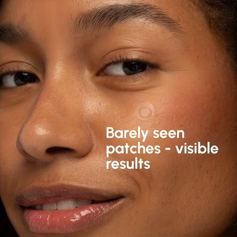 Toneur™ NightDart Pimple Patches