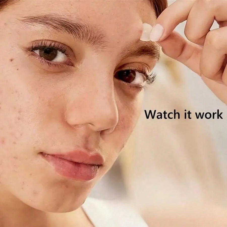 Toneur™ NightDart Pimple Patches